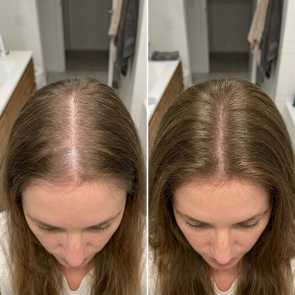 The Korean Scalp Secret — Buy 1, Get 1 FREE