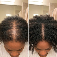 The Korean Scalp Secret — Buy 1, Get 1 FREE