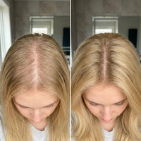 The Korean Scalp Secret — Buy 1, Get 1 FREE